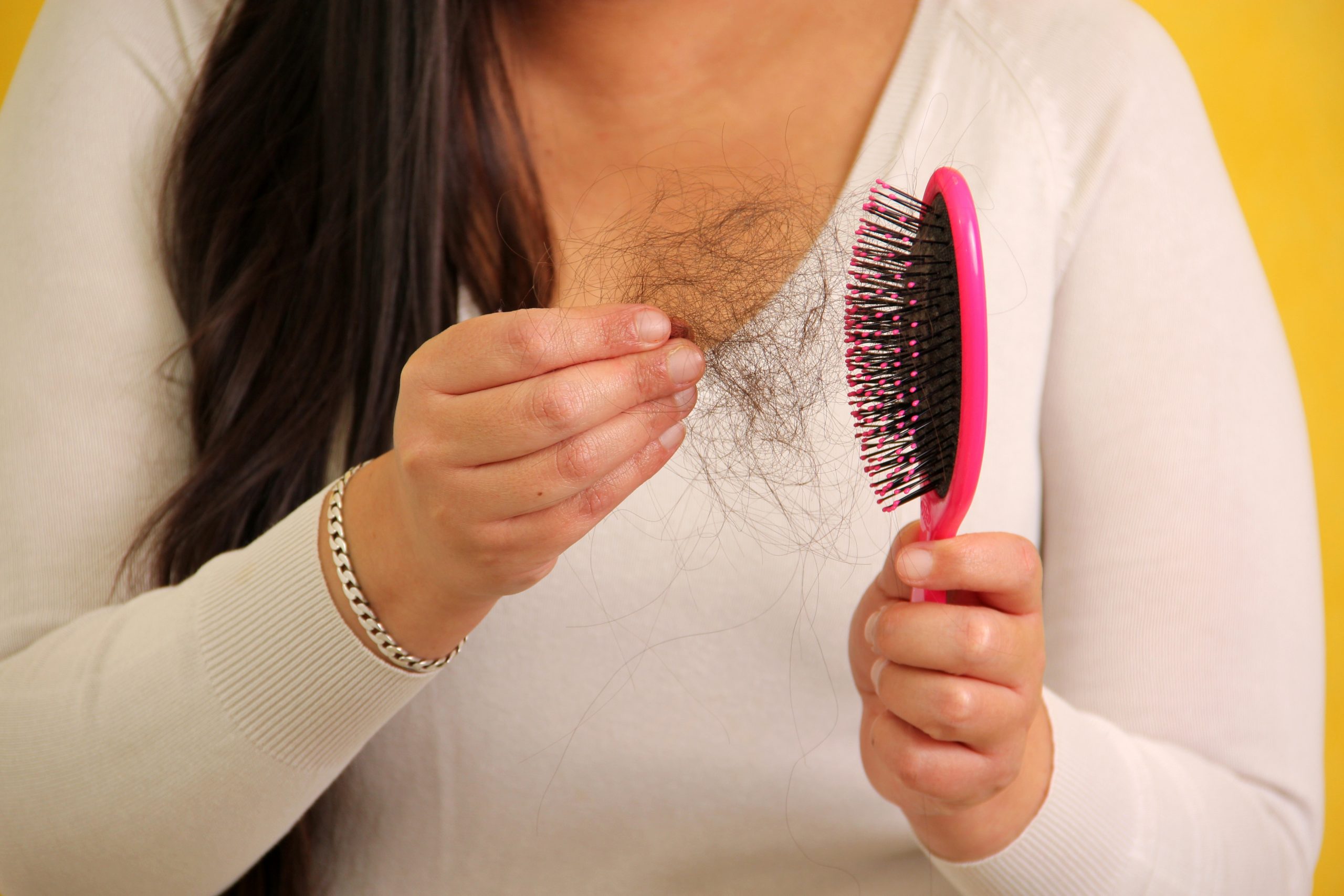 The Connection between Hair Loss and Thyroid Disorders